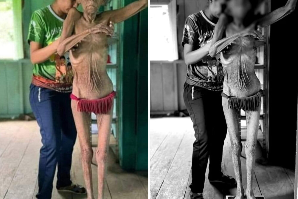 Morre mulher Yanomami fotografada em estado grave de desnutrição; ela tinha 65 anos 